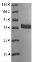 Mycobacterium tuberculosis Probable cutinase Rv1984c (Rv1984c) Recombinant Protein - BioCrest Sci