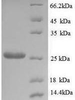 Saccharomyces cerevisiae Trehalose-phosphatase (TPS2), partial Recombinant Protein, N-His, aa 703–895 - BioCrest Sci