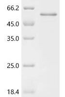 Rat Latent transforming growth factor beta binding protein 4 (Ltbp4), partial Recombinant Protein - BioCrest Sci
