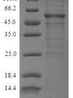 Human Protein Wnt-5a (WNT5A) Recombinant Protein, N-10His-SUMO/C-myc - BioCrest Sci
