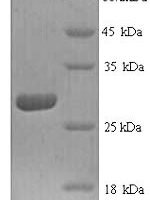 Human Cathepsin K (CTSK) Recombinant Protein - BioCrest Sci