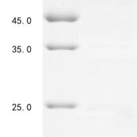 Human Calpain-8 (CAPN8) Recombinant Protein, N-His - BioCrest Sci
