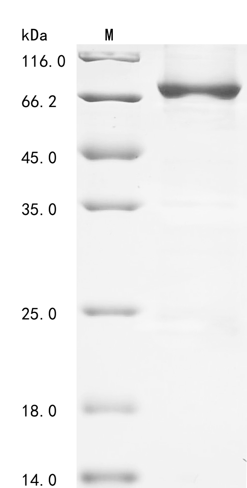 Human Calpain-8 (CAPN8) Recombinant Protein, N-His, Homo sapiens (Human), E.coli, N-terminal 6xHis-tagged, 83.2 kDa, purity >≥ 85% as determined by SDS-PAGE.
