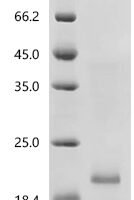 Mouse Receptor activity-modifying protein 3 (Ramp3), partial Recombinant Protein, C-His, aa 23–117, E.coli - BioCrest Sci