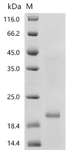 Mouse Receptor activity-modifying protein 3 (Ramp3), partial Recombinant Protein, C-His, aa 23–117, E.coli, Mus musculus (Mouse), E.coli, C-terminal 6xHis-tagged, 18.0 kDa, purity >≥ 90% as determined by SDS-PAGE.