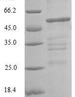 Human Chloride intracellular channel protein 4 (CLIC4) Recombinant Protein - BioCrest Sci