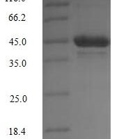 Mouse [Pyruvate dehydrogenase (acetyl-transferring)] kinase isozyme 1, mitochondrial (Pdk1) Recombinant Protein - BioCrest Sci