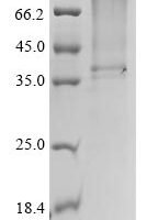 Escherichia coli Type 1 fimbrin D-mannose specific adhesin (fimH) Recombinant Protein, C-His - BioCrest Sci