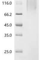 Human Delta and Notch-like epidermal growth factor-related receptor (DNER), partial Recombinant Protein, C-His, aa 35–640, Yeast - BioCrest Sci