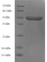 Human Protein ETHE1, mitochondrial (ETHE1) Recombinant Protein - BioCrest Sci