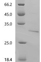 Human GTPase KRas (KRAS) (G12C), partial Recombinant Protein, N-10His - BioCrest Sci