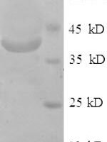 Human Long-chain fatty acid transport protein 2 (SLC27A2), partial Recombinant Protein, N-His - BioCrest Sci