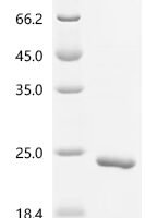 Human Bromodomain-containing protein 4 (BRD4), partial Recombinant Protein, C-His, aa 49–170 - BioCrest Sci