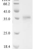 Mouse Ly-6/neurotoxin-like protein 1 (Lynx1) Recombinant Protein, N-His-SUMOstar - BioCrest Sci