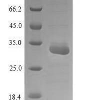 Corylus avellana Major pollen allergen Cor a 1 isoforms 5, 6, 11 and 16 Recombinant Protein, N-His-SUMO - BioCrest Sci