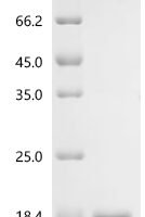 Bovine Regakine-1 Recombinant Protein, C-His, aa 22–92, E.coli - BioCrest Sci