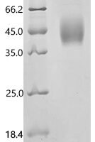 Human T-lymphocyte activation antigen CD80 (CD80), partial, Biotinylated Recombinant Protein - BioCrest Sci
