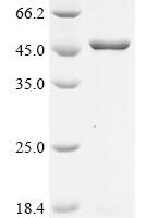 Human herpesvirus 6B Envelope glycoprotein B (gB), partial Recombinant Protein - BioCrest Sci