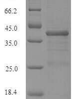Human Serine/arginine-rich splicing factor 10 (SRSF10) Recombinant Protein - BioCrest Sci