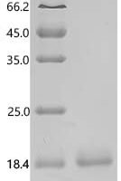 Cat Beta-2-microglobulin (B2M) Recombinant Protein, C-His, aa 21–118, Yeast - BioCrest Sci