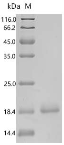 Cat Beta-2-microglobulin (B2M) Recombinant Protein, C-His, aa 21–118, Yeast, Felis catus (Cat) (Felis silvestris catus), Yeast, C-terminal 6xHis-tagged, 12.7 kDa, purity >≥ 95% as determined by SDS-PAGE.