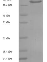 Human Coiled-coil domain-containing protein 36 (CCDC36), partial Recombinant Protein - BioCrest Sci