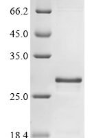Human Muscarinic acetylcholine receptor M1 (CHRM1), partial Recombinant Protein - BioCrest Sci