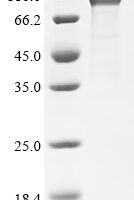 Human CD44 antigen (CD44), partial Recombinant Protein, C-hFc1 - BioCrest Sci
