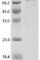 Mouse High affinity cGMP-specific 3',5'-cyclic phosphodiesterase 9A (Pde9a) Recombinant Protein, C-10His - BioCrest Sci