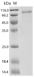 Mouse High affinity cGMP-specific 3',5'-cyclic phosphodiesterase 9A (Pde9a) Recombinant Protein, C-10His, Mammalian cell, C-terminal 10xHis-tagged, 67.9 kDa, purity >≥ 95% as determined by SDS-PAGE.