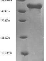 Zaire ebolavirus Matrix protein VP40 (VP40) Recombinant Protein - BioCrest Sci