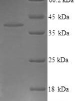 Mouse Proto-oncogene Wnt-3 (Wnt3) Recombinant Protein, N-His - BioCrest Sci