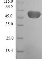 Human Elongation factor 1-beta (EEF1B2) Recombinant Protein - BioCrest Sci