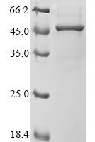 Human Acetyl-CoA acetyltransferase, cytosolic (ACAT2) Recombinant Protein - BioCrest Sci