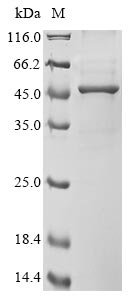 Human Acetyl-CoA acetyltransferase, cytosolic (ACAT2) Recombinant Protein, Homo sapiens (Human), E.coli, N-terminal 10xHis-tagged and C-terminal Myc-tagged, 48.8 kDa, purity >≥ 85% as determined by SDS-PAGE.