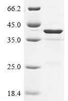 Mouse Platelet endothelial aggregation receptor 1 (Pear1), partial Recombinant Protein - BioCrest Sci