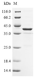 Mouse Platelet endothelial aggregation receptor 1 (Pear1), partial Recombinant Protein, Mus musculus (Mouse), E.coli, N-terminal 10xHis-tagged, 34.9 kDa, purity >≥ 85% as determined by SDS-PAGE.