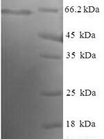 Human Echinoderm microtubule-associated protein-like 2 (EML2), partial Recombinant Protein - BioCrest Sci