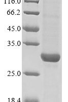 Nc-DigChim-324430, partial Recombinant Protein - BioCrest Sci
