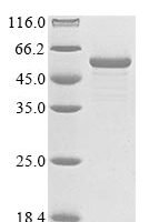Escherichia coli Bifunctional protein GlmU (glmU) Recombinant Protein, N-10His/C-Myc - BioCrest Sci