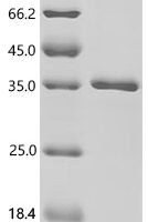 Mouse Extracellular superoxide dismutase [Cu-Zn] (Sod3) Recombinant Protein - BioCrest Sci
