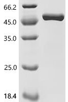 Mouse CAP-Gly domain-containing linker protein 1 (Clip1), partial Recombinant Protein - BioCrest Sci