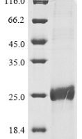 Human papillomavirus 11 Protein E6 (E6) Recombinant Protein, N-His - BioCrest Sci