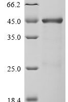 Human Neurosecretory protein VGF (VGF), partial Recombinant Protein - BioCrest Sci