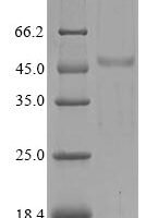 Human SH3 domain-containing YSC84-like protein 1 (SH3YL1) Recombinant Protein, N-His/C-Myc - BioCrest Sci