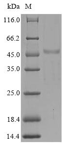 Human SH3 domain-containing YSC84-like protein 1 (SH3YL1) Recombinant Protein, N-His/C-Myc, Homo sapiens (Human), Yeast, N-terminal 6xHis-tagged and C-terminal Myc-tagged, 40.6 kDa, purity >≥ 85% as determined by SDS-PAGE.