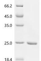 Staphylococcus aureus Large ribosomal subunit protein bL12 (rplL) Recombinant Protein - BioCrest Sci