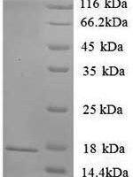 Rat Sortilin (Sort1), partial Recombinant Protein, N-His, aa 610–754, Yeast - BioCrest Sci