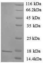 Rat Sortilin (Sort1), partial Recombinant Protein, N-His, aa 610–754, Yeast, Rattus norvegicus (Rat), Yeast, N-terminal 6xHis-tagged, 18.5 kDa, purity >≥ 90% as determined by SDS-PAGE.
