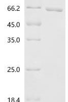 Pseudomonas aeruginosa B-type flagellin (fliC) Recombinant Protein - BioCrest Sci
